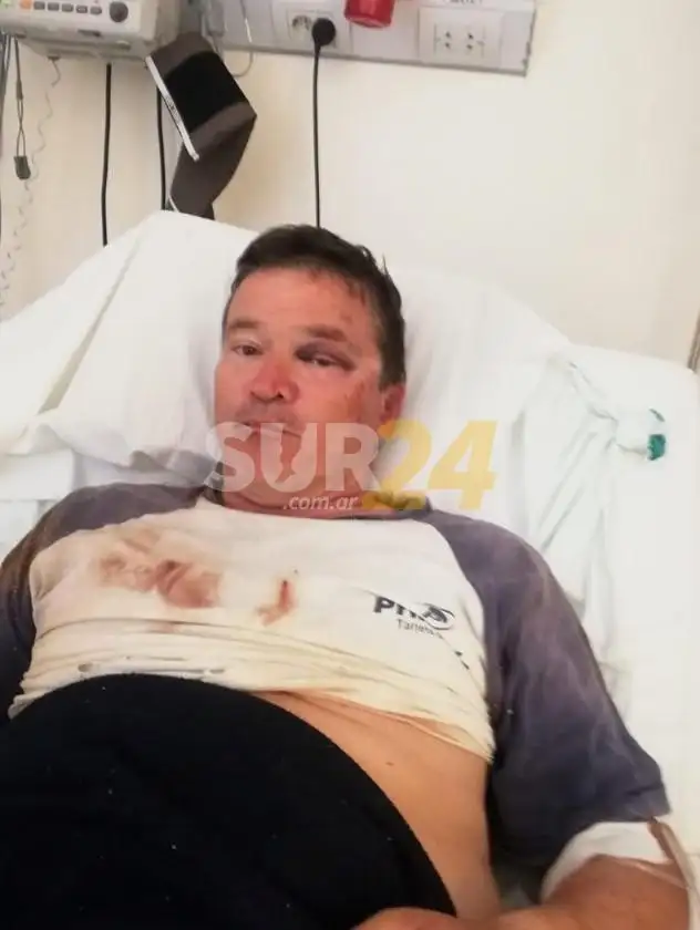 Habló el productor al que torturaron para robarle en San Eduardo