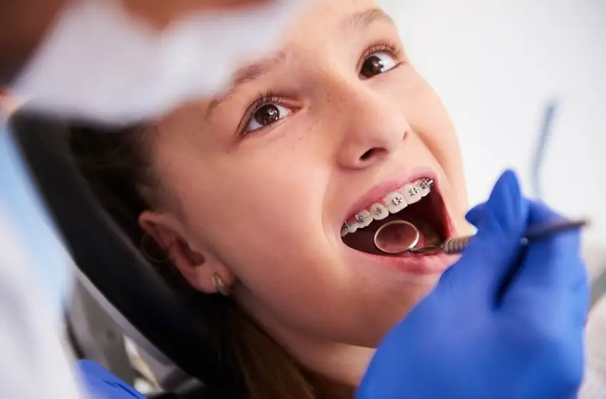 ¿Sabés cuáles son los mejores brakets para vos?
