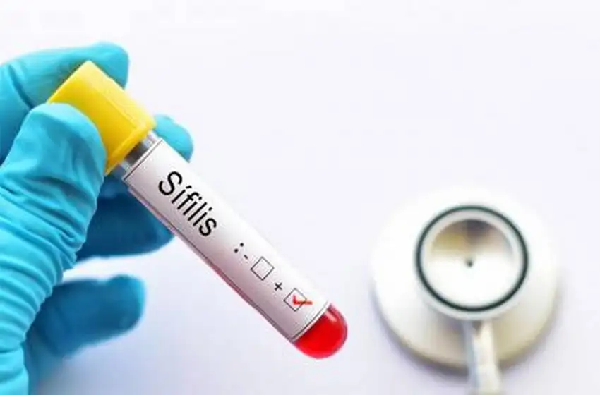 Preocupa el crecimiento de casos de sífilis del país
