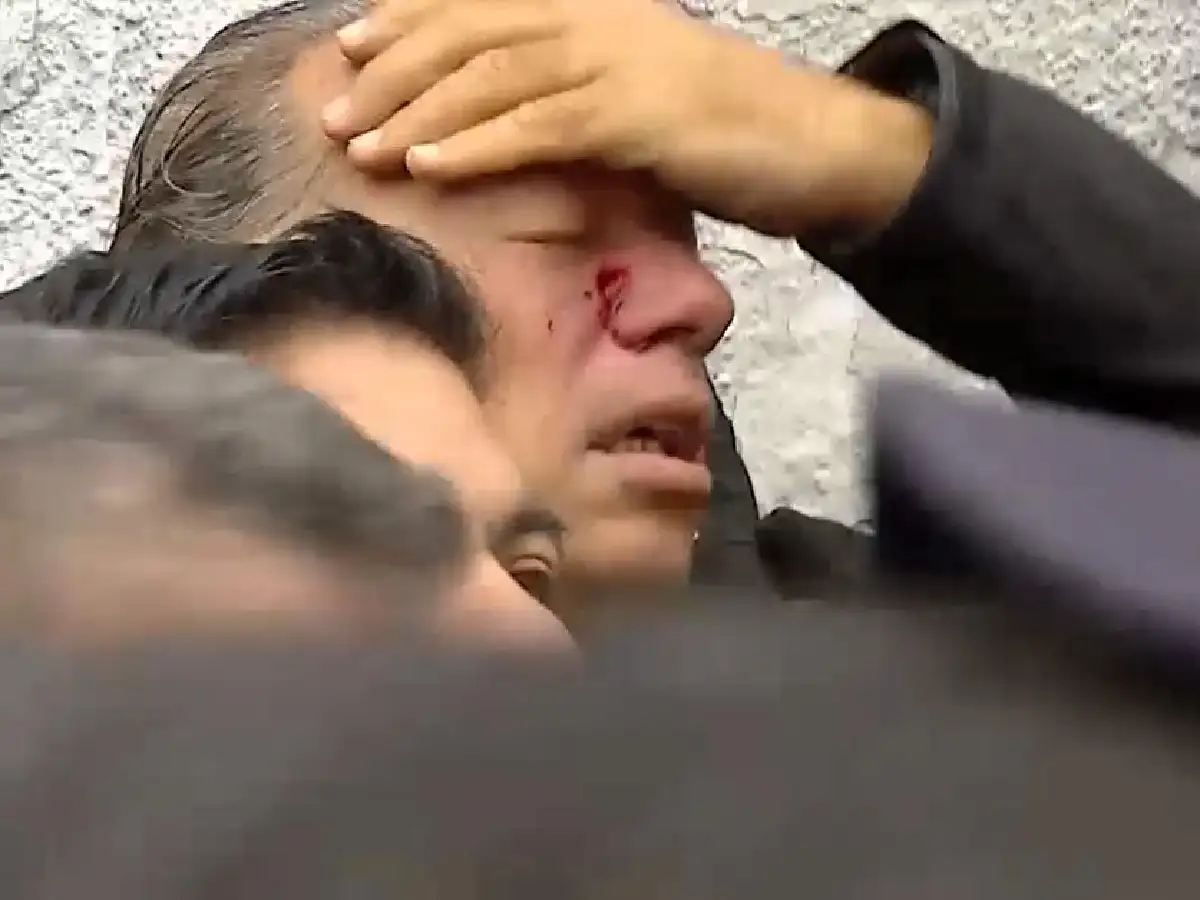 Berni seguirá adelante con su denuncia contra los colectiveros que lo agredieron