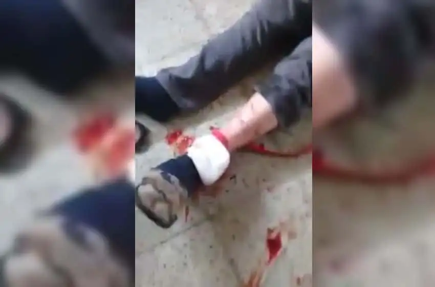 Félix U. Camet: preocupan dos perros que atacan a vecinos