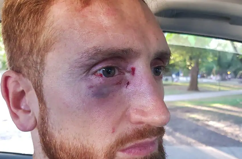 El mensaje de repudio de Campazzo por la brutal agresión contra un basquetbolista en Mar del Plata