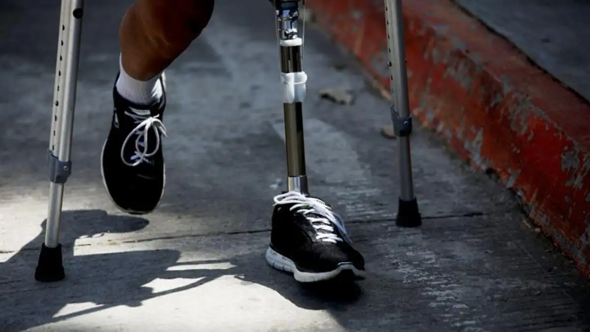 Un hospital vasco reclama al propietario de una pierna amputada que vaya a recogerla