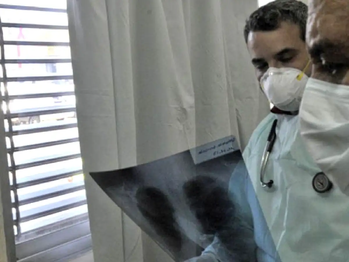 Por el aislamiento, bajaron los casos de neumonía, influenza y enfermedades virales