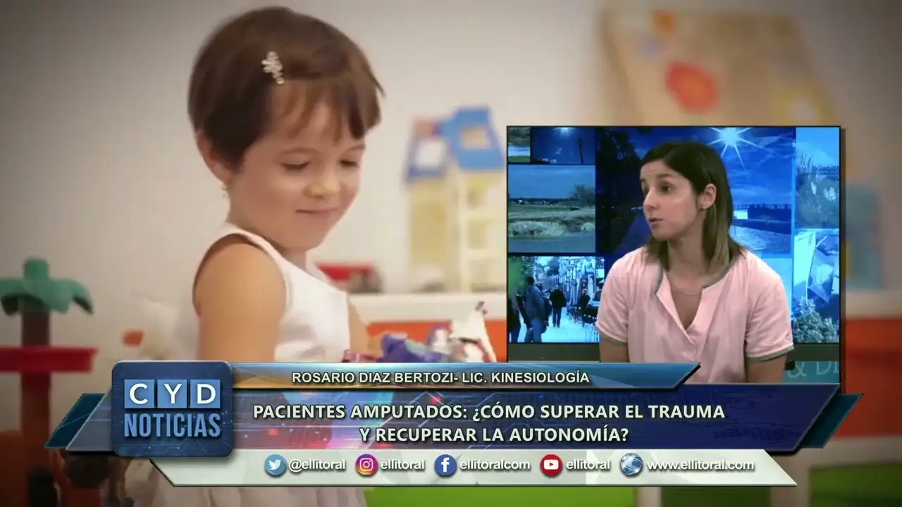 Pacientes amputados: ¿cómo superar el trauma y recuperar la autonomía?