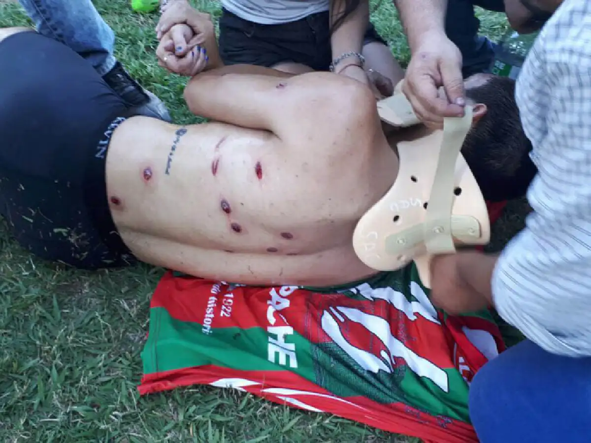 Brutal represión policial  en una liga de Santa Fe