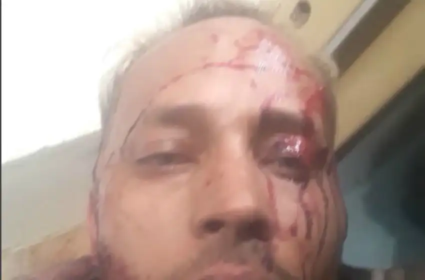 Venezuela: murió el opositor Oscar Pérez