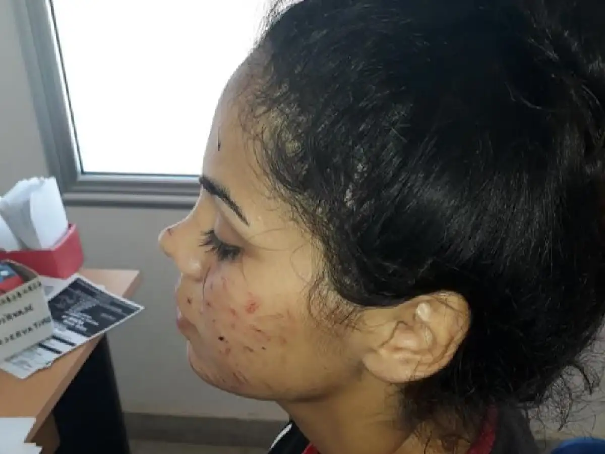 Tras la denuncia y detención, amenazan a la familia de joven atacada en Frontera