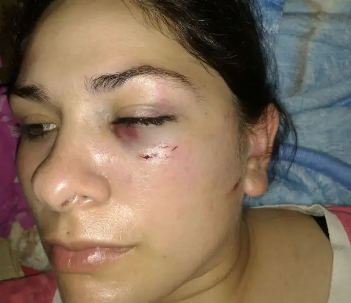 Detuvieron a agresora de una policía