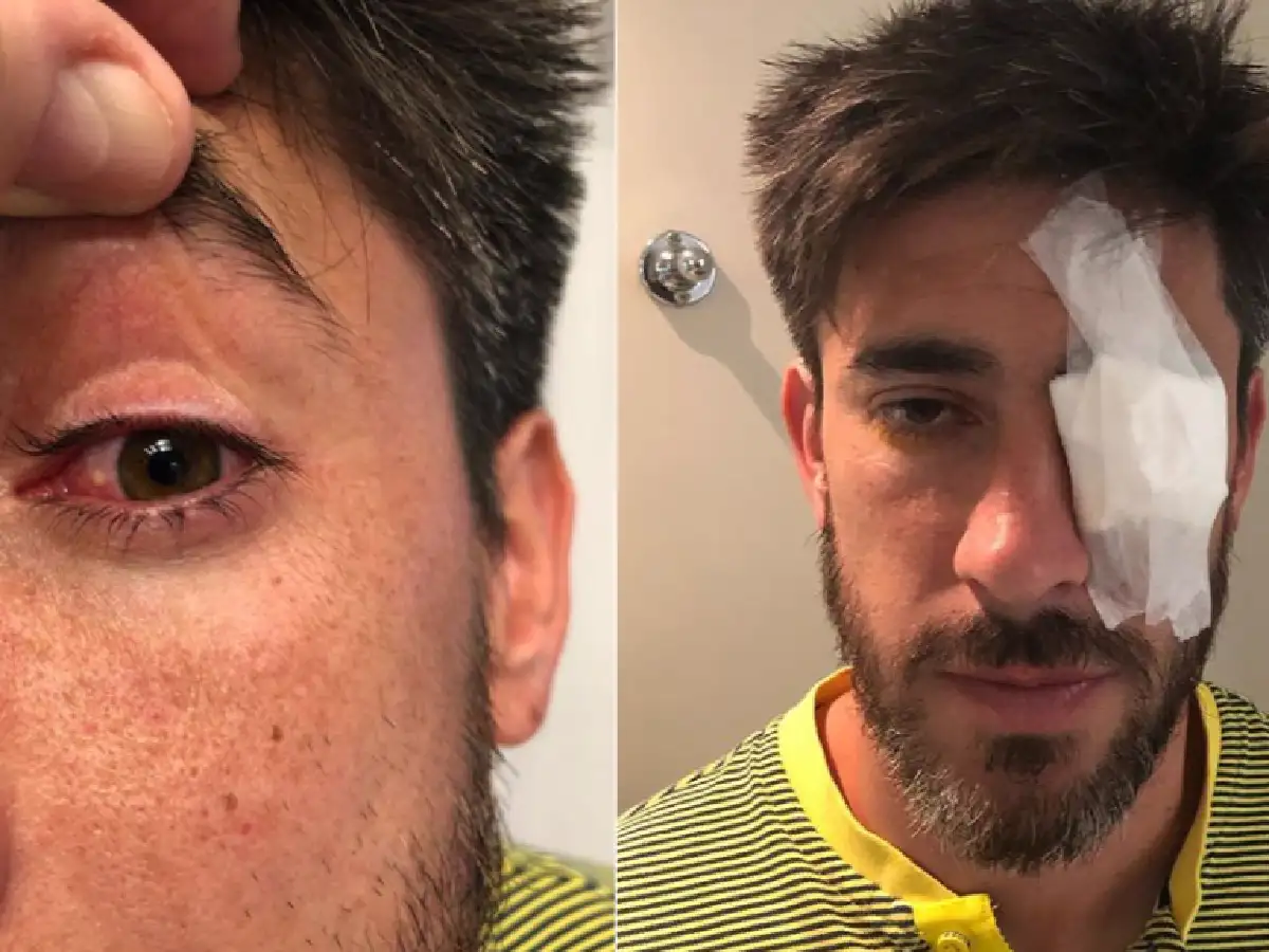Habló el médico que atendió a Pablo Pérez: "La lesión que tiene le imposibilita la visión"