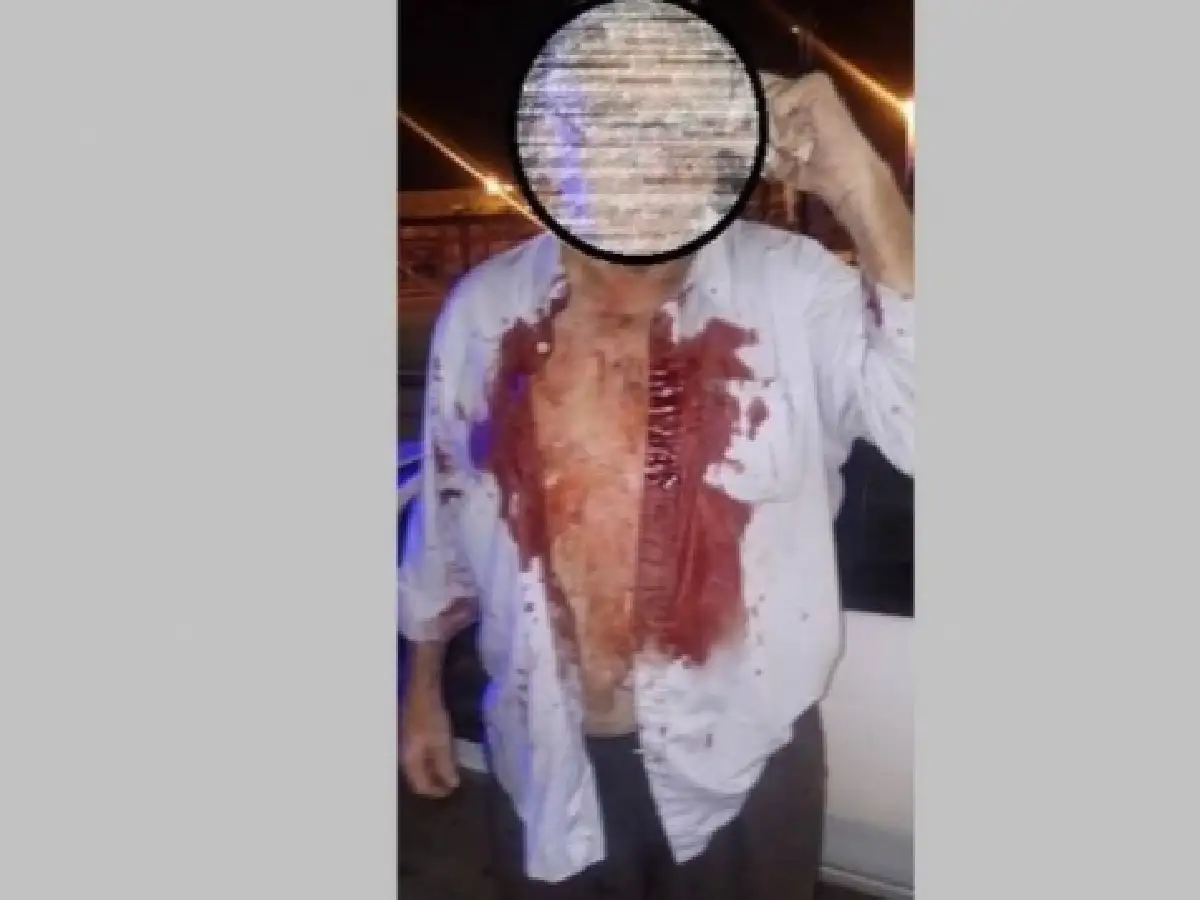Rafaela: Feroz golpiza a un remisero para robarle