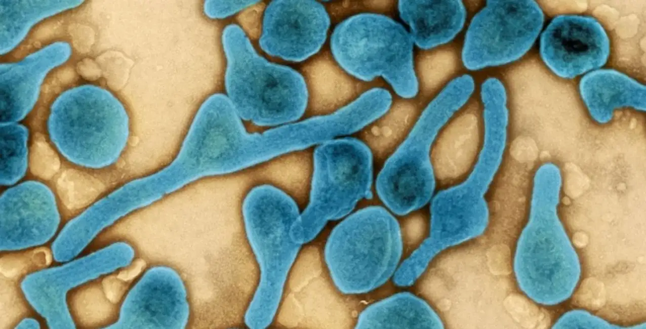 Virus de Marburgo: cuáles son los síntomas de la enfermedad y qué riesgos trae