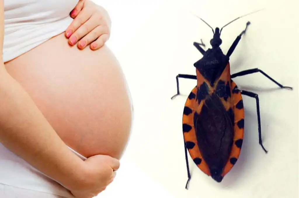 En el país, cada año nacen entre 1.200 y 1.300 bebés con Chagas congénito.