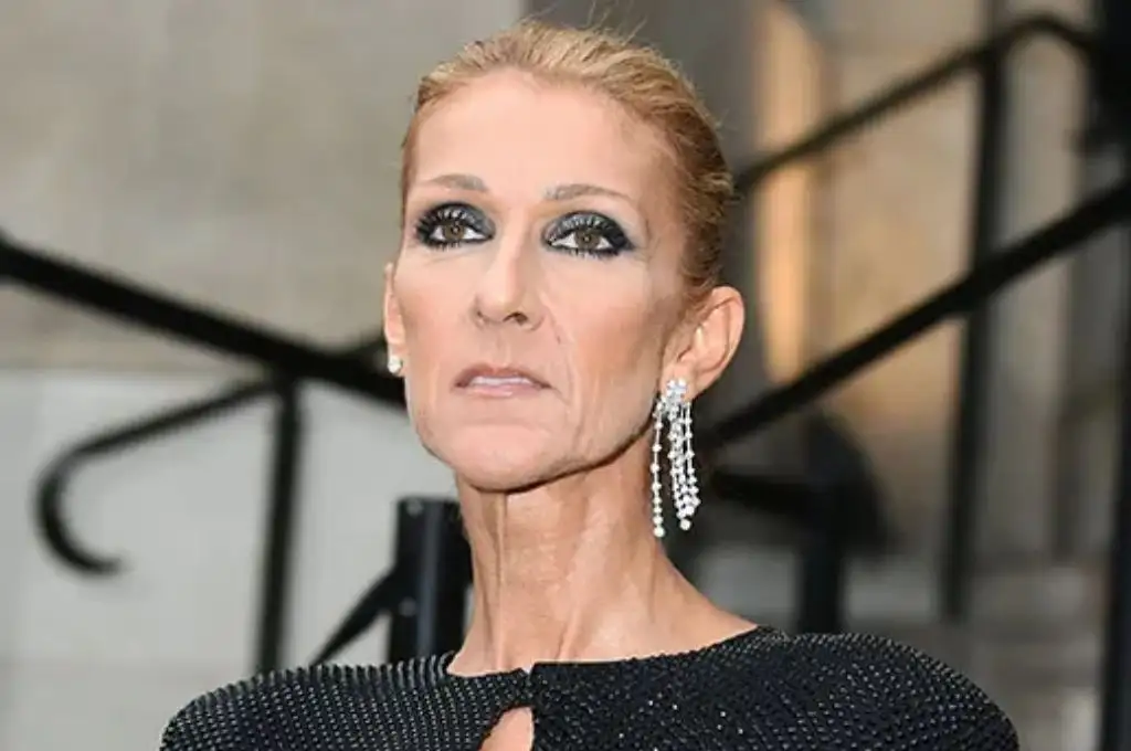 Céline Dion, de 55 años, padece el Síndrome de la Persona Rígida