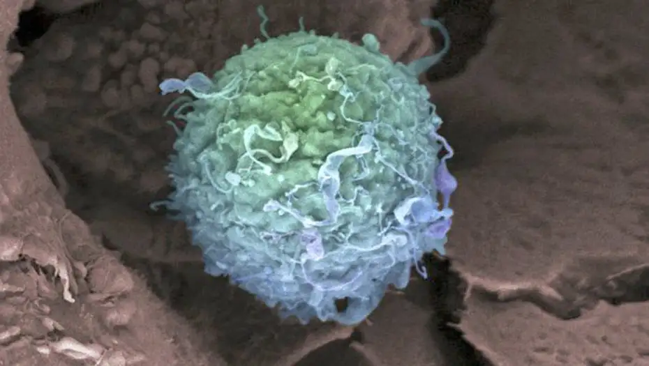 Una nueva “biopsia líquida” permitiría detectar el cáncer antes de que se desarrolle
