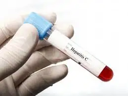 Hepatitis C: a partir de lunes comienza la campaña de detección