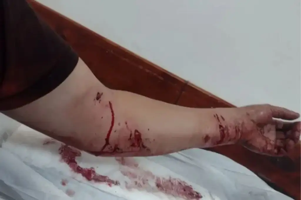 Sufrieron profundas heridas