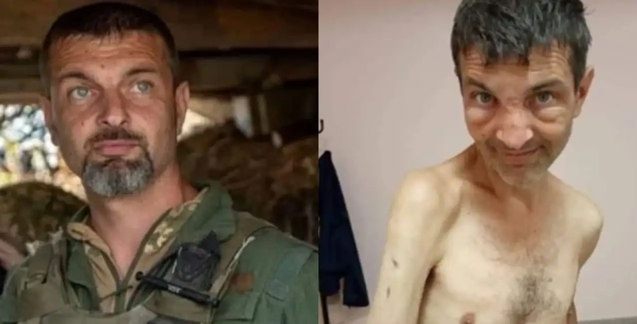 El antes y el despúes de un soldado ucraniano tras ser liberados del cautiverio ruso