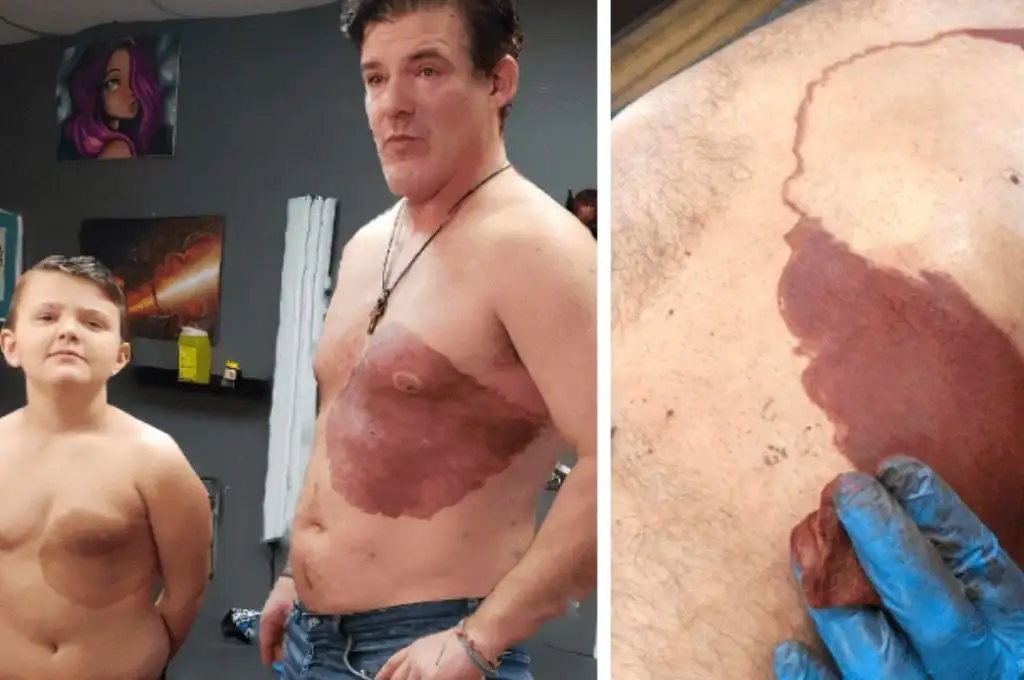 VIRAL. Se tatuó la mancha que tiene su hijo para darle confianza