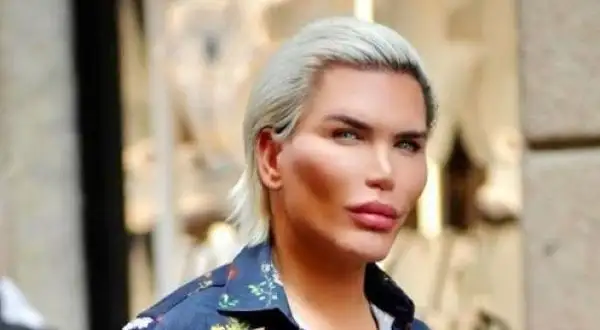 El “Ken humano” está a punto de quedarse sin nariz
