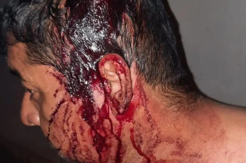 Brutal golpiza en Santiago del Estero: amenazó a su expareja y su ex suegro lo agarró a machetazos