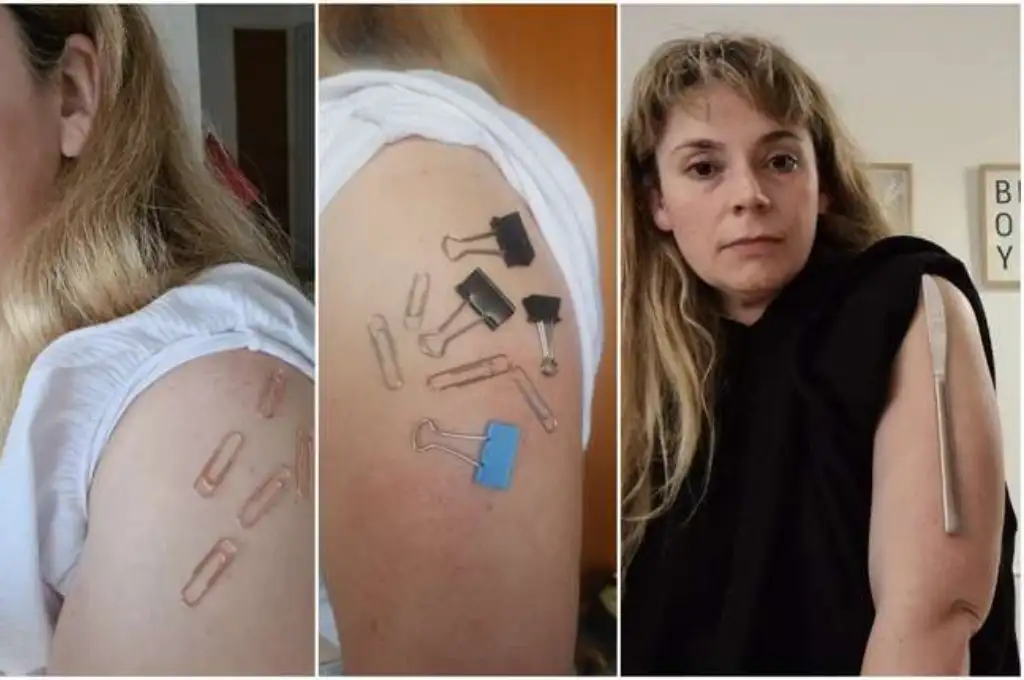 Una mujer denuncia que quedó “imantada” tras vacunarse contra el Covid