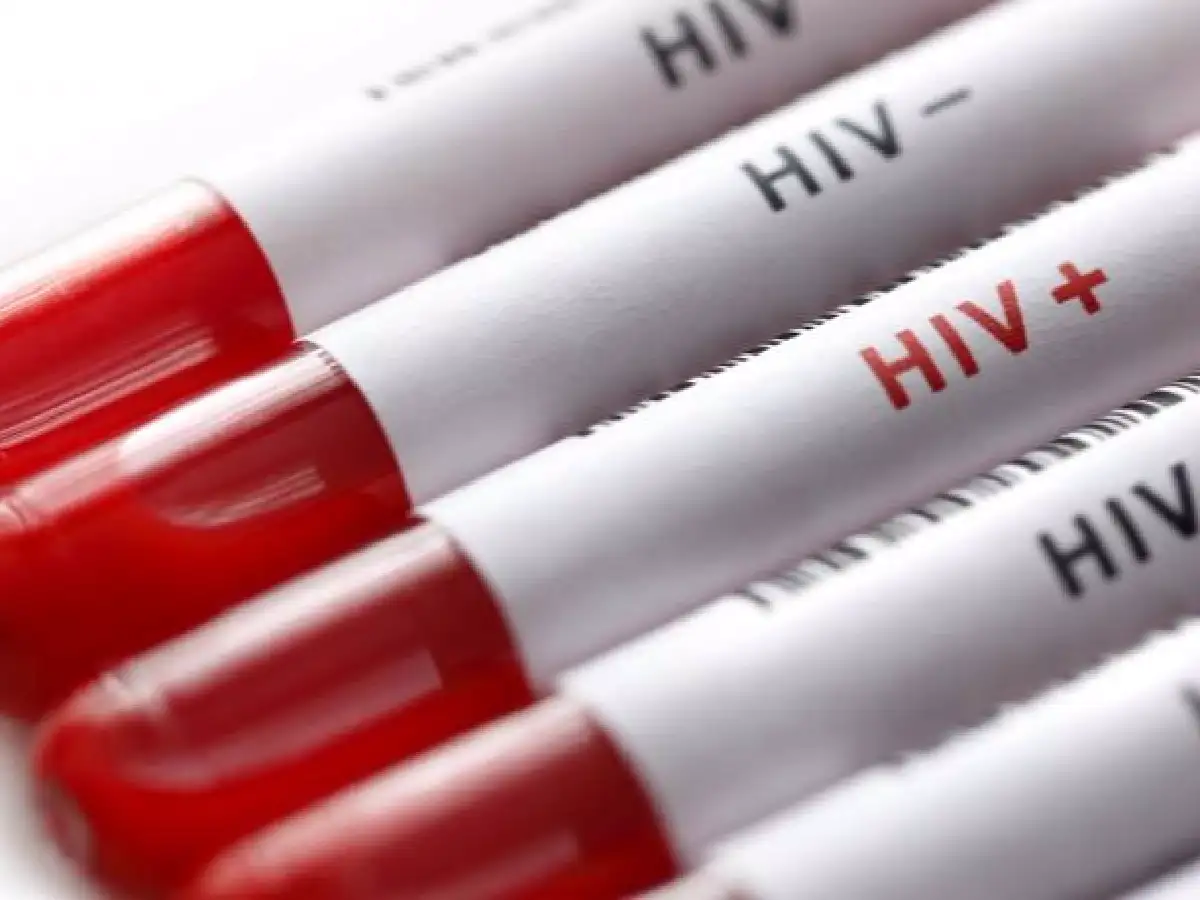 VIH: Por primera vez producirán un medicamento en el país