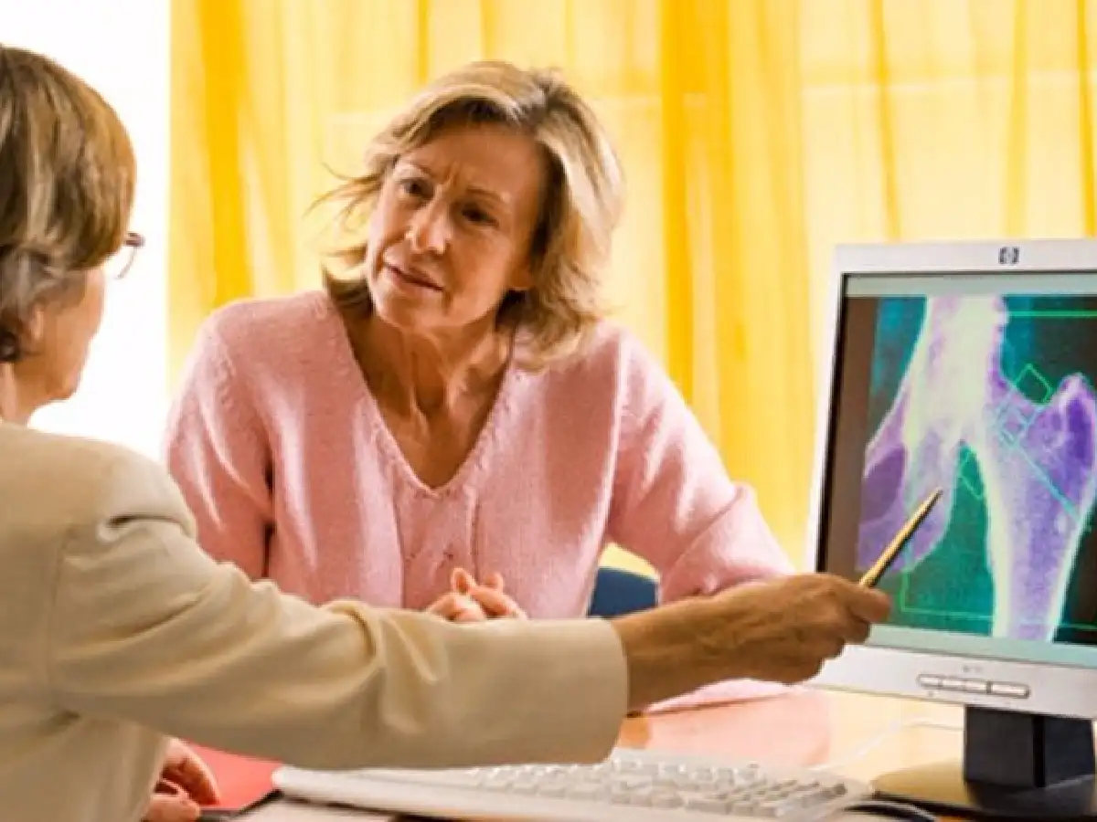  Desarrollaron un software que permitiría  mejorar el diagnóstico de la osteoporosis