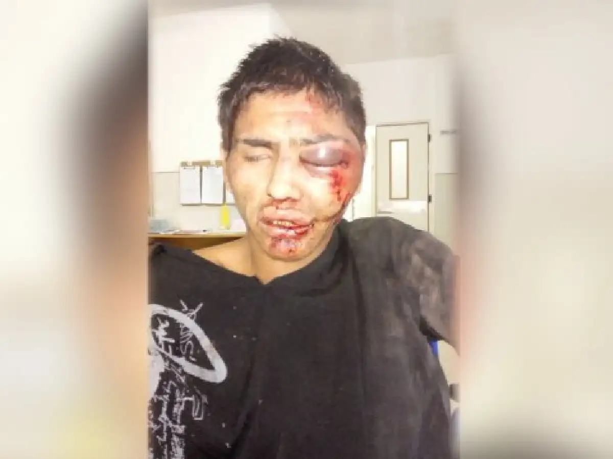 Vuelven a detener a joven que intentó robar celular y fue golpeado por vecinos 