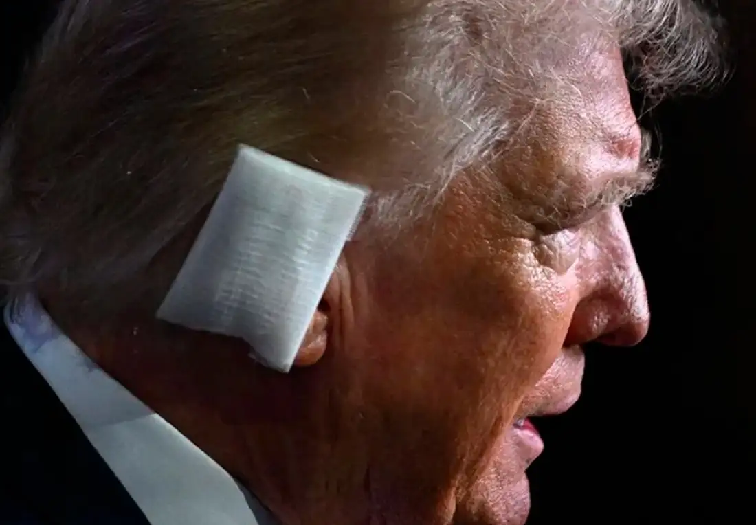 Con una venda en la oreja, Donald Trump dio su primer discurso público tras el atentado.