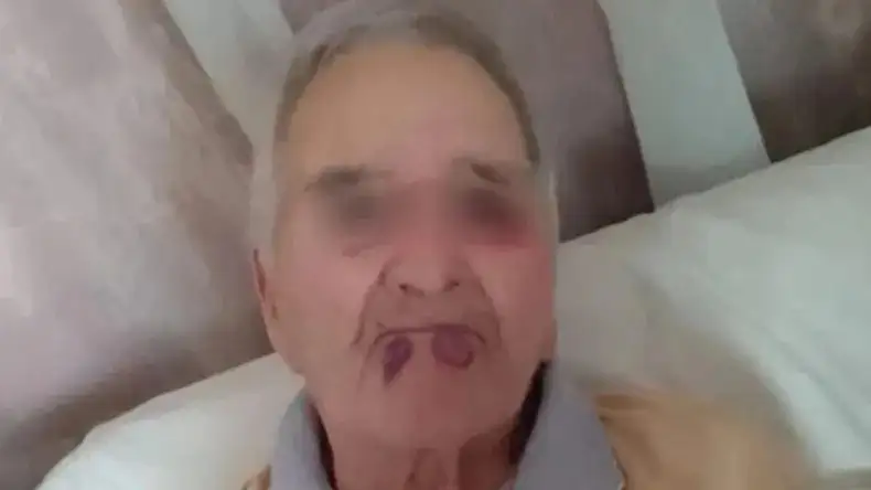 Héctor Salas, de 89 años, recibió golpes en el rostro e investigan al geriátrico donde residía.