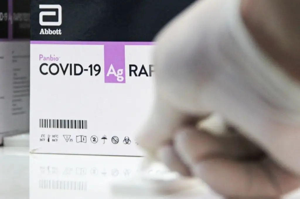 Covid-19: brindan recomendaciones para el uso de test de antígenos