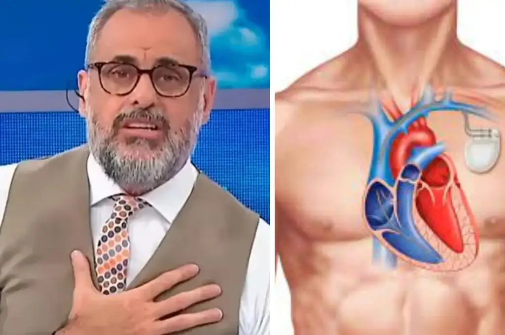 Cómo funciona el cardiodesfibrilador que le colocaron a Jorge Rial