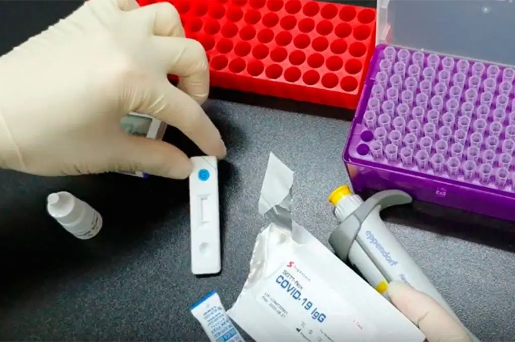 Entre Ríos: confirmaron 17 nuevos casos de coronavirus, 10 son de Paraná