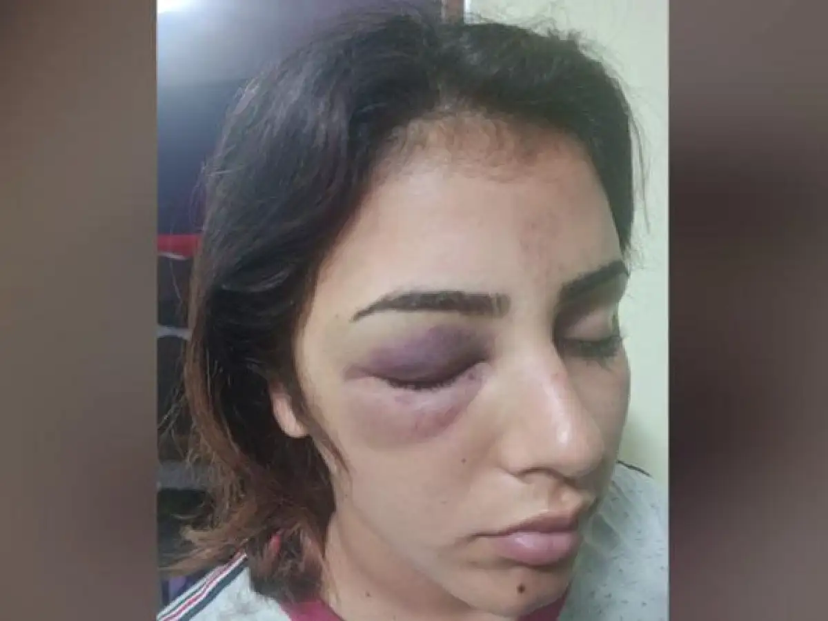 Imputan por lesiones graves a dos de las tres presuntas agresoras de joven en Arroyito