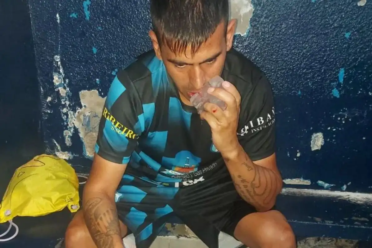 David Boquín, destacada figura de Deportivo Rincón, sufrió cortes en el labio inferior derecho-