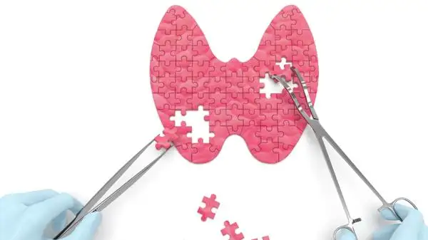 Efecto mariposa, cómo saber cuándo falla la glándula tiroides